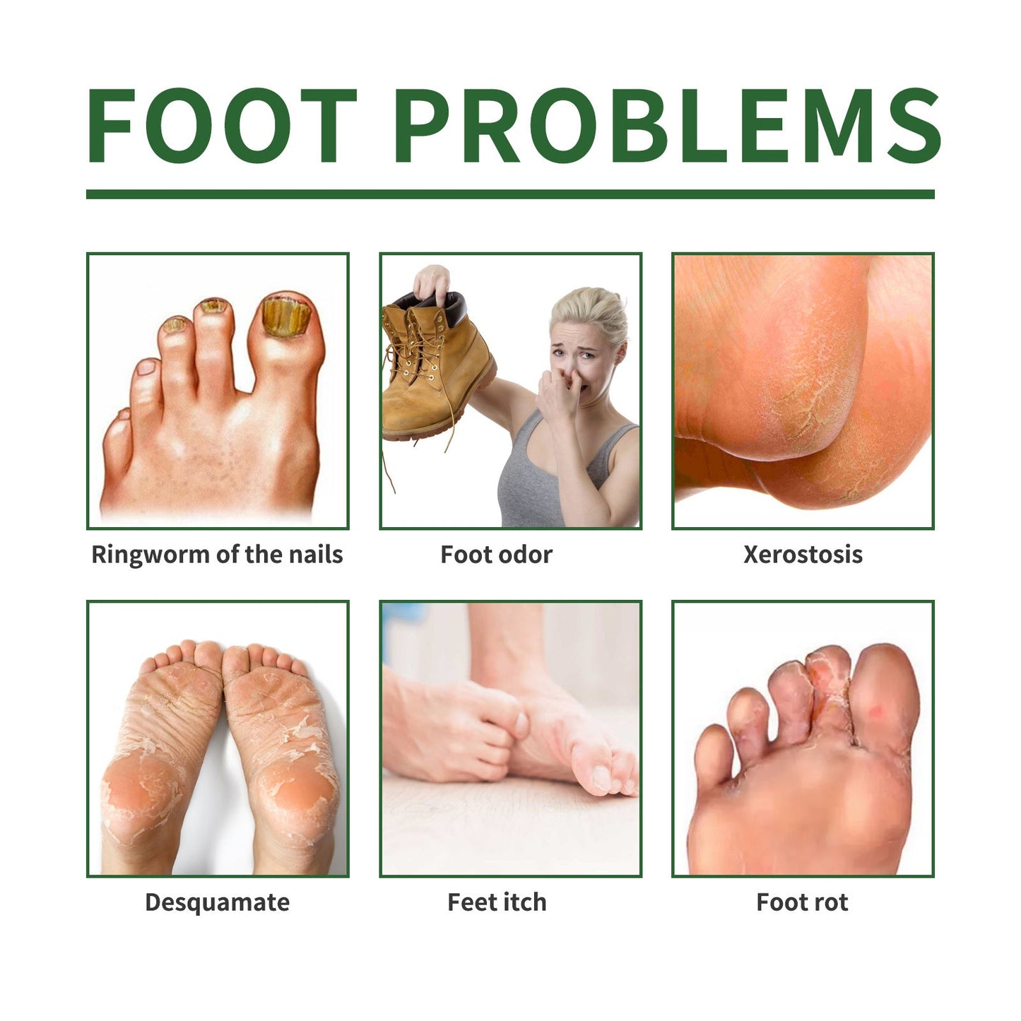 Heel Renewal Foot Treatment