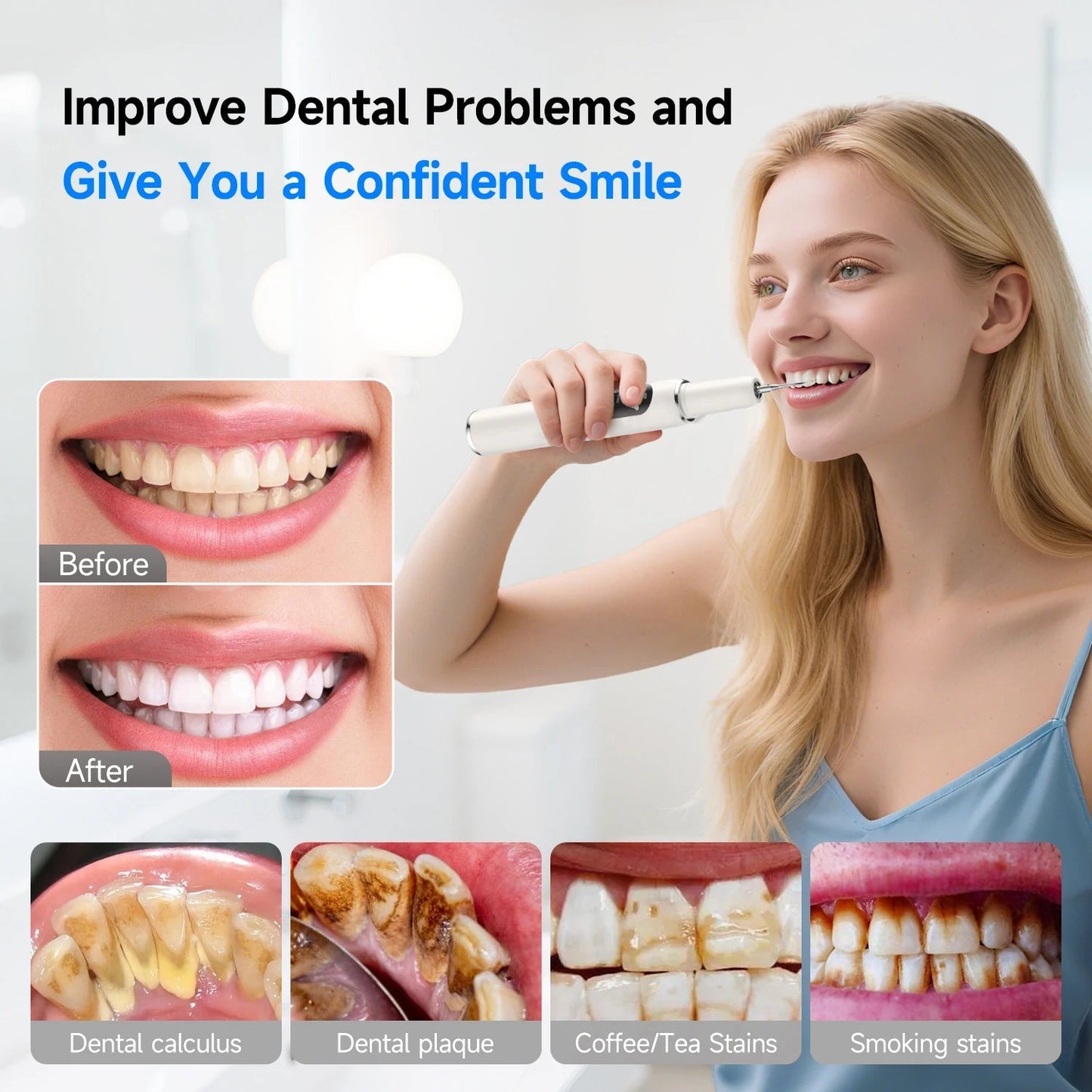 Ultrasonic Electric Dental Scaler High Frequency Vibrating Teeth